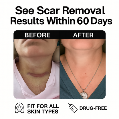 Silicone Scar Healing Tape™